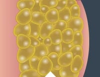 Fat_Cells_Closeup_1_Desktop Fat_Cells_Closeup_1_Desktop