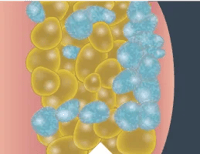 Fat_Cells_Closeup_2_Desktop_259x200 Fat_Cells_Closeup_2_Desktop_259x200