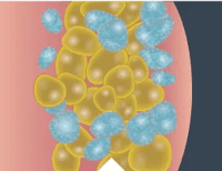 Fat_Cells_Closeup_3_Desktop_259x200 Fat_Cells_Closeup_3_Desktop_259x200