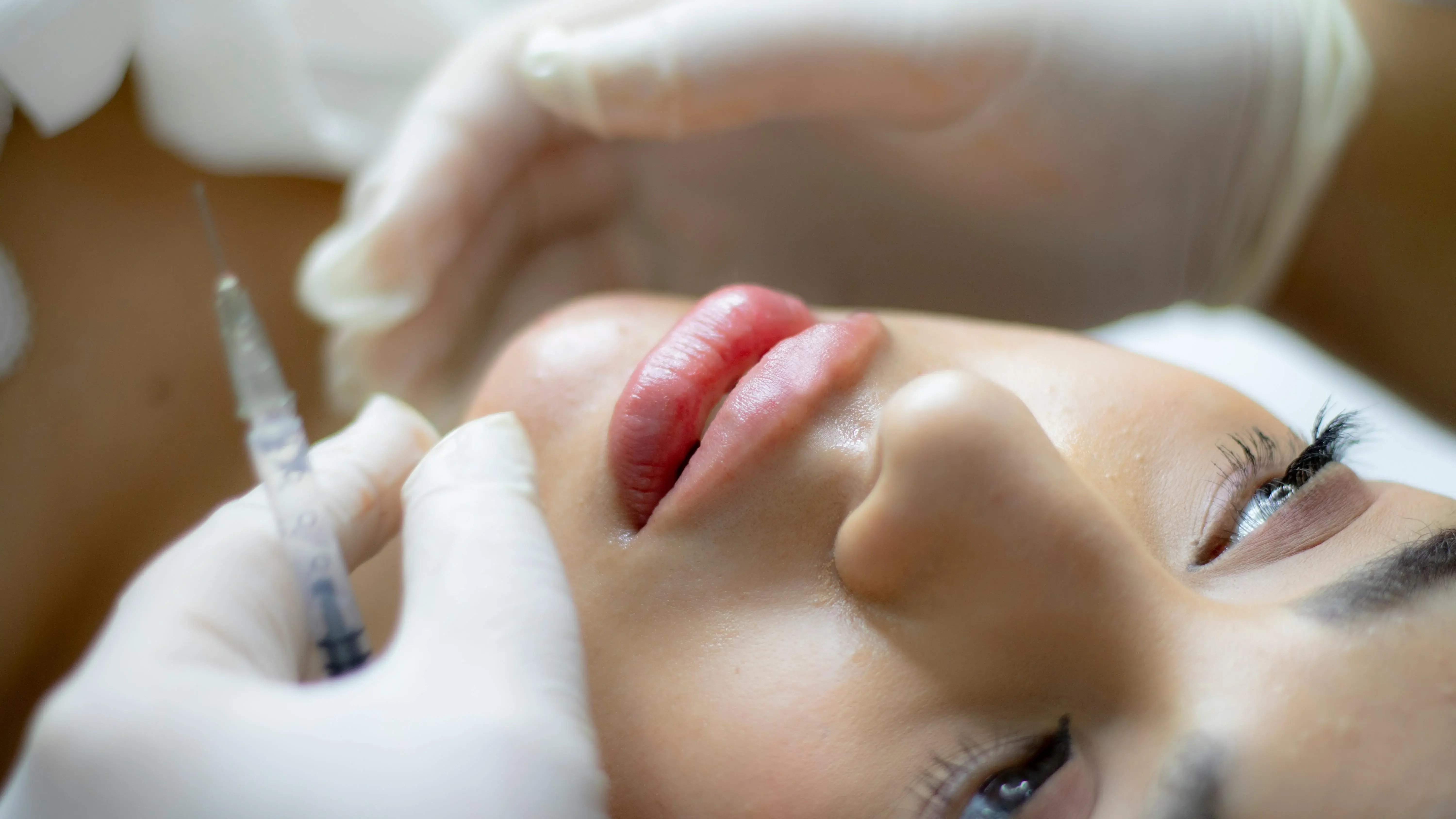 close up of lip filler treatment