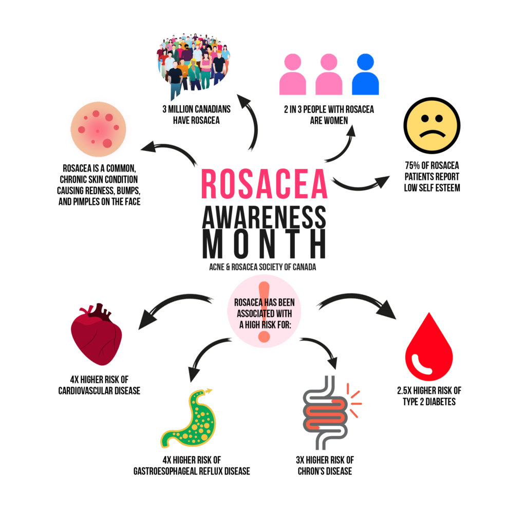 April is Rosacea Awareness Month: Rosacea visible marker for more serious diseases?