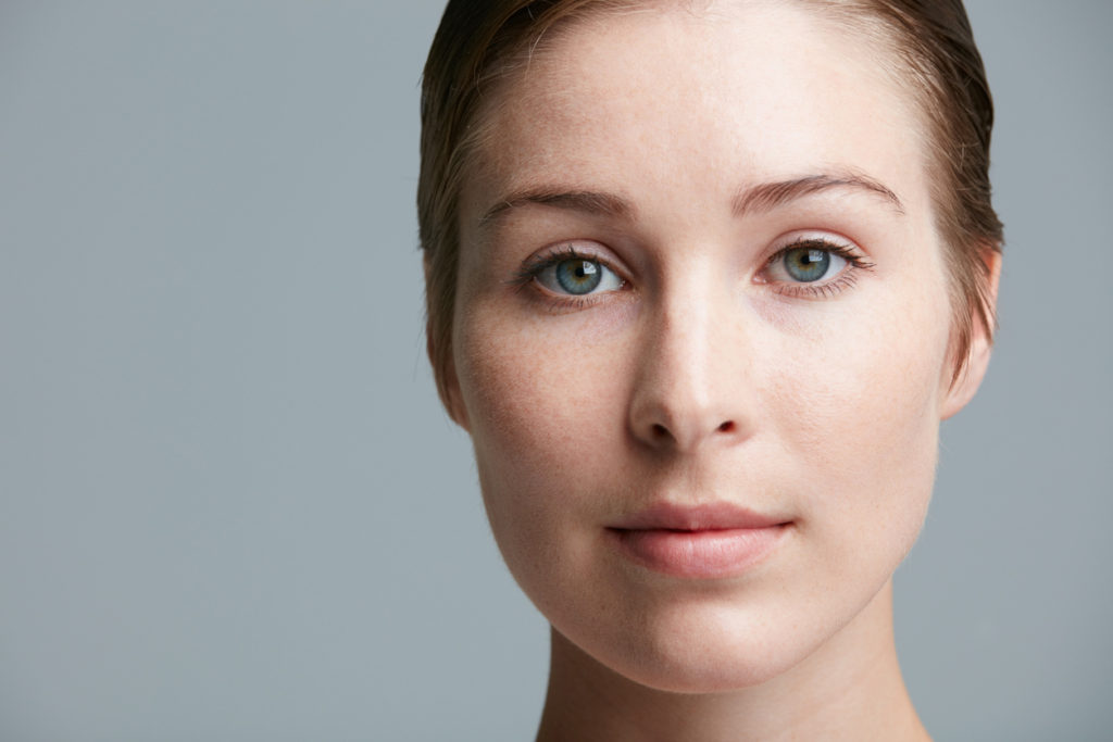 Blackheads: Causes, treatments, prevention